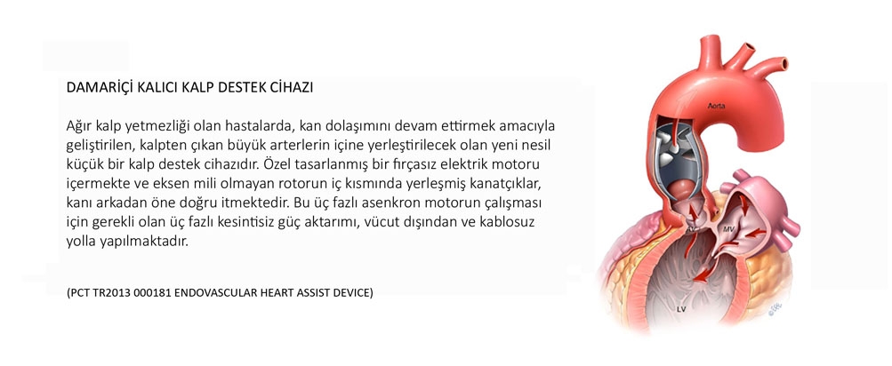 Damar ii kalp destek cihaz
