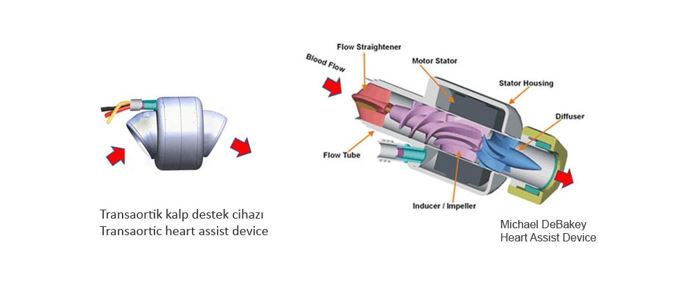 Transarteriyel kalp destek cihaz